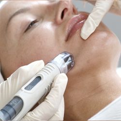 Microneedling